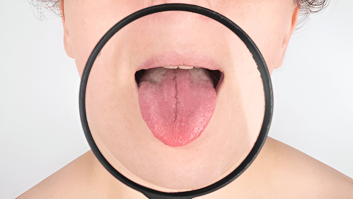 Close-up of a person sticking out their tongue with a magnifying glass highlighting it